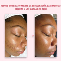 Almohadillas de ácido kójico y cúrcuma pack x 40 unid + ENVIO GRATIS
